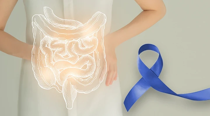 Vastagbélrákszűrés – életmentő lehet, ha ezt elolvassa