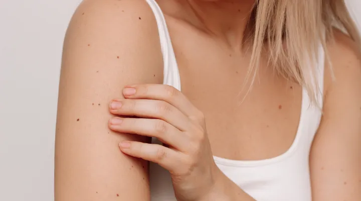 How to protect your skin during the summer months