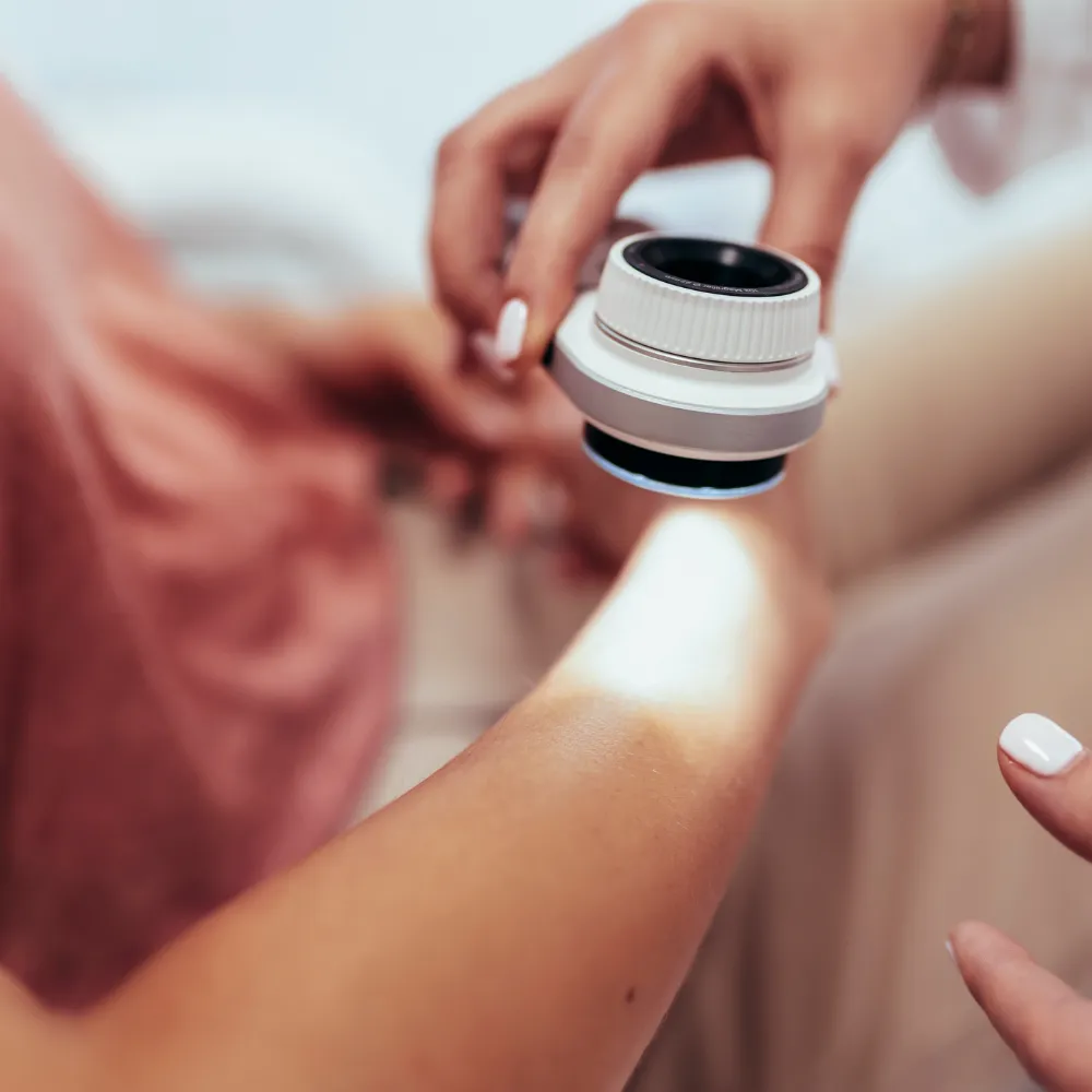 30% kedvezmény dermatoszkópos anyajegyszűrésre