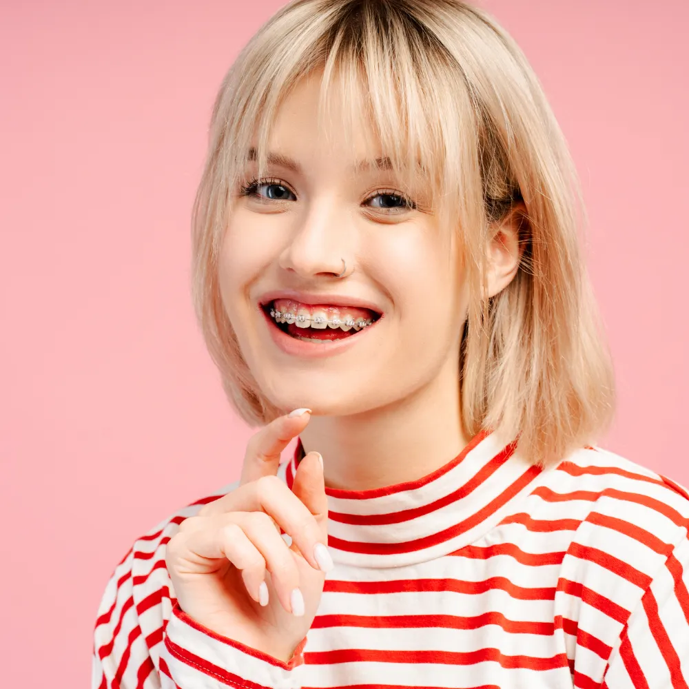 Tavaszi fogszabályozási kedvezmény